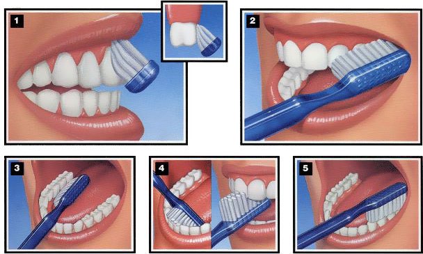  ۲۵ درمان دندان درد به روش ساده